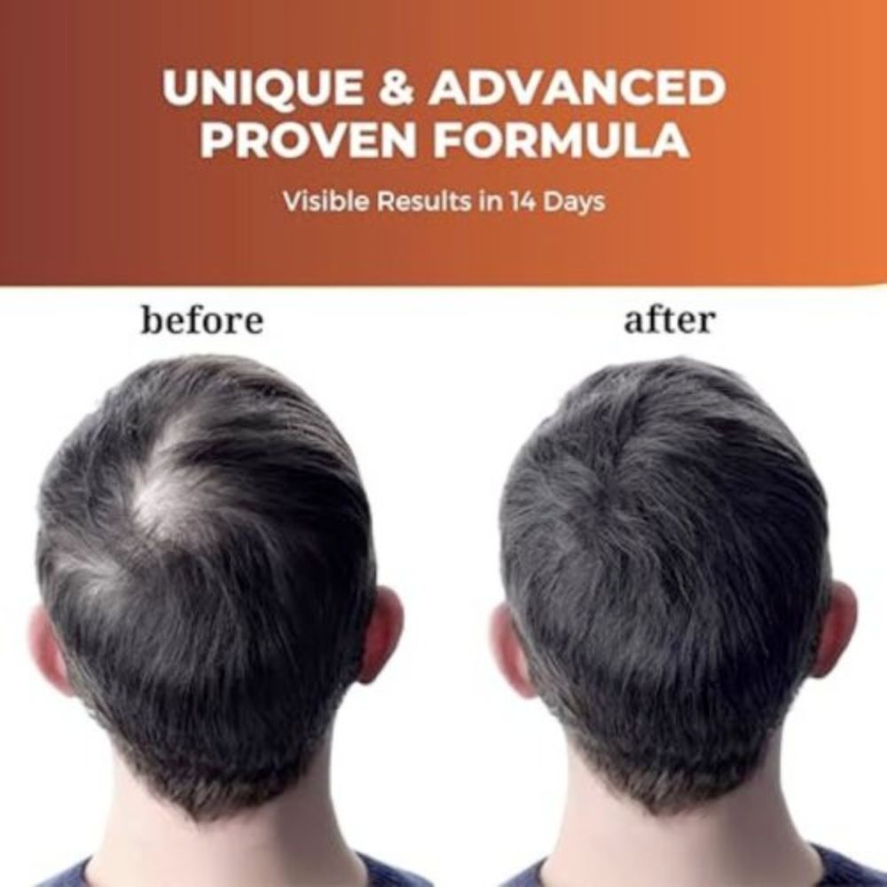 Prisa Organics Hair Serum ( For Hair Regrowth) 45ml